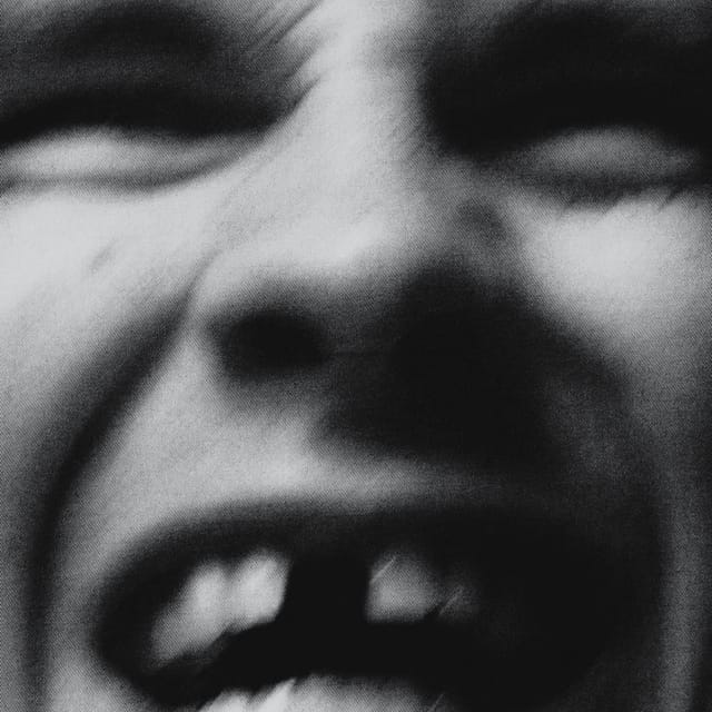 Anomali